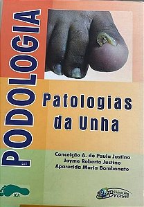 Podologia: Patologias da Unha - Conceição A. de Paula
