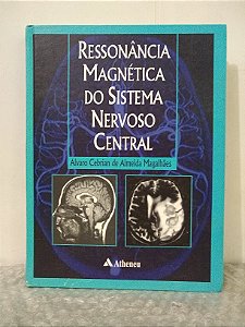 Ressonância Magnética do Sistema Nervoso Central - Alvaro Cebrian de Almeida Magalhães