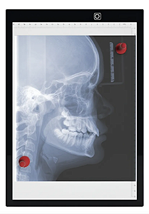 Negatoscópio 1 Corpo Led Médico Panorâmico Portátil Mesa A4