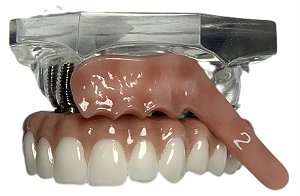 Manequim Odontológico Protocolo Superior 6 Implantes