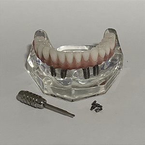 Manequim Modelo Odontológico Protocolo Inferior