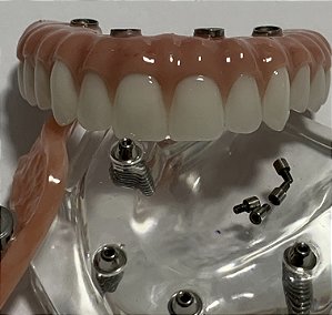 Manequim Modelo Odontológico Protocolo Superior All-On-Four