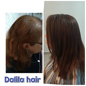 PRÓTESE CAPILAR LÍVIA CABELO HUMANO
