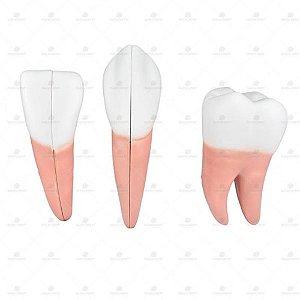 Modelo anatômico de dentes em 6 partes, ampliados em aproximadamente 10 vezes, unidade, mod.: SD5059/H (Sdorf)