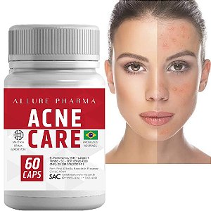 Acne Care  Prevenção e Tratamento para Acne e Pele Oleosa  Sem efeitos colaterais