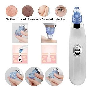 Aparelho De Sucção À Vácuo Para Remover Cravos E Espinhas S/ Machucar