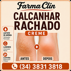 Calcanhar ou Seios Rachados