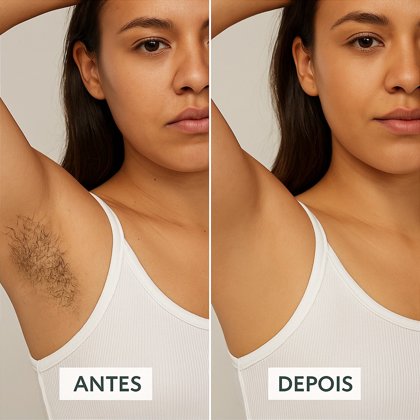 Antes e depois na axila com Inibidor de Pelos Dermo Skin LABOTRAT