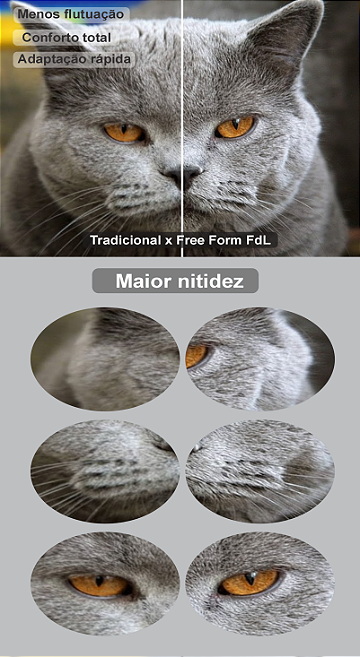 Free Form FdL Lateral