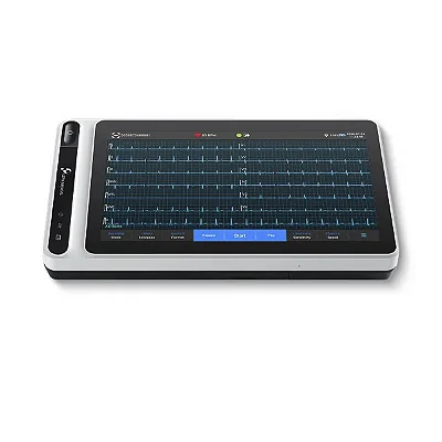 Eletrocardiógrafo Portátil Digital 12 Canais S120