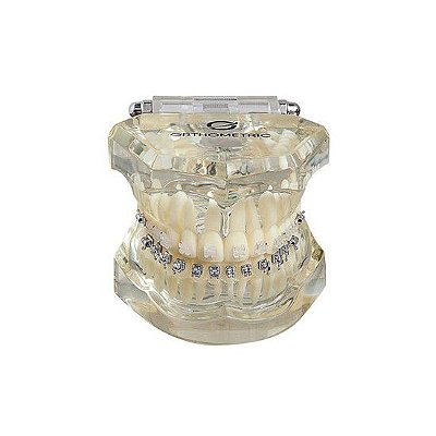 Manequim Ortodontico Misto Iceram, Safira, Advanced, Ultra-P - Orthometric