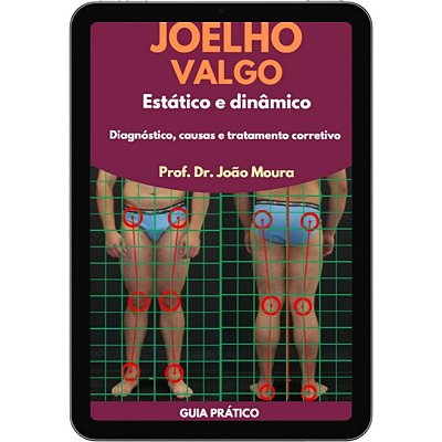 E-book: JOELHO VALGO DINÂMICO E ESTÁTICO: DIAGNÓSTICO E CORREÇÃO PARA PROFISSIONAIS DE EDUCAÇÃO FÍSICA