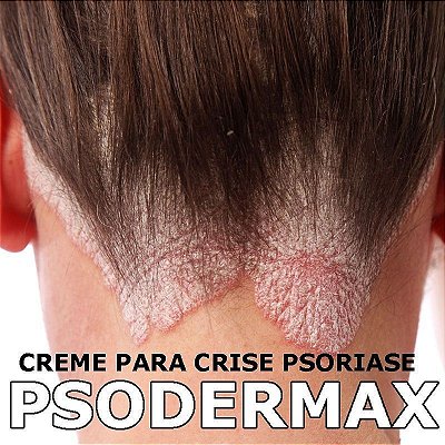 Psodermax creme para crise de psoriase - 30 gr