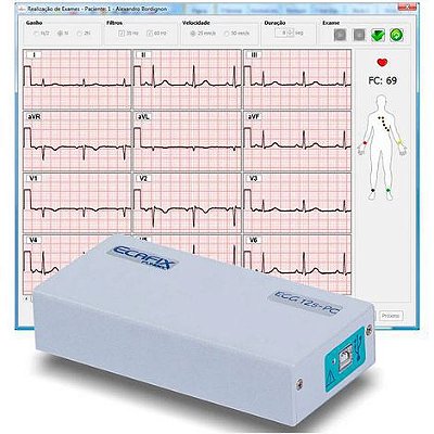 Eletrocardiógrafo 12 derivações para uso em Notebook ou Desktop PC com Software para Windows ECG-12S Ecafix