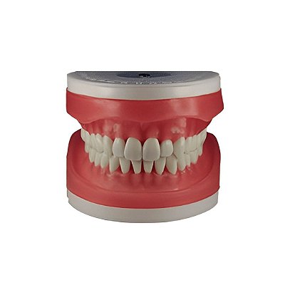 Refil Top Dentística AC103  - PRONEW