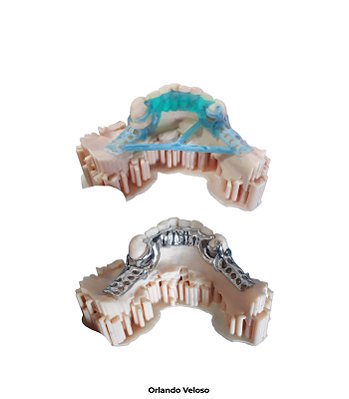 Resina 3D Odontológica PrintaX Press & Cast Blue 500g