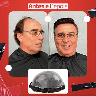 JAC 08 - 0,08mm PROTESE CAPILAR DE MICROPELE SEM KIT MANUTENÇÃO