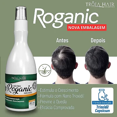 MINOXIDIL MINOX 15- 100ML