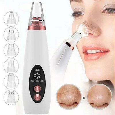 Máquina Sucção Removedor De Cravos Espinhas Cleaning Acne A Vácuo USB
