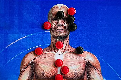 Biomagnetismo