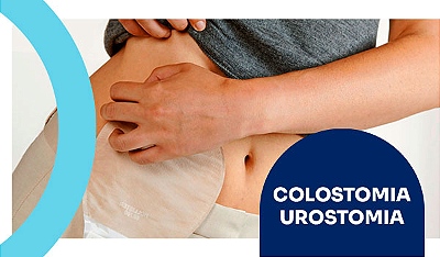 Categoria Colostomia