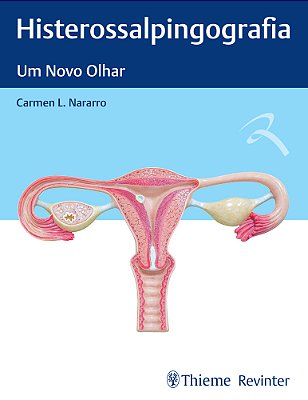 Histerossalpingografia Um Novo Olhar..-