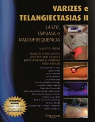 Varizes E Telangiectasias II - Laser, Espuma E Radiofrequencia..-