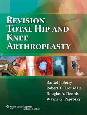 Revision Total Hip And Knee Arthroplasty 1 Ed 2011-..