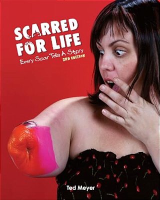 Scarred For Life. 2ND Edition: Every Scar Tells A Story-..