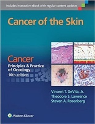 Cancer Of The Skin - Cancer, Principles And Practice Of Oncology-..