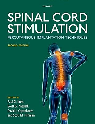 Spinal Cord Stimulation: Percutaneous Implantation Techniques-..