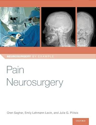 Pain Neurosurgery-..
