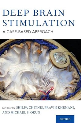 Deep Brain Stimulation: A Case-Based Approach-..