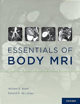 Essentials Of Body Mri-..