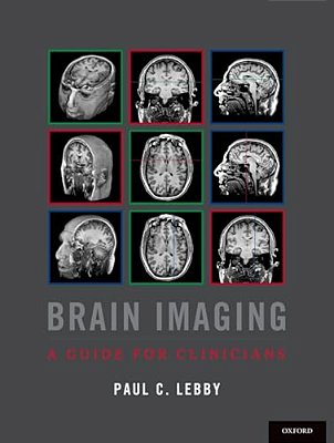 Brain Imaging: A Guide For Clinicians-..