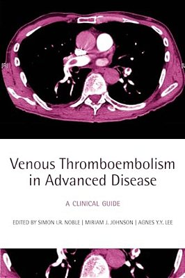 Venous Thromboembolism In Advanced Disease: A Clinical Guide-..