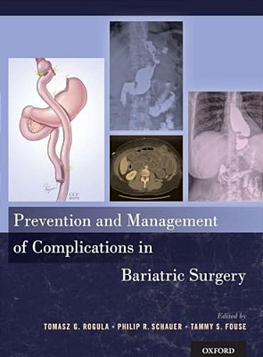 Prevention And Management Of Complications In Bariatric Surgery-..