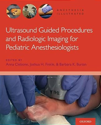 Ultrasound Ai P-..