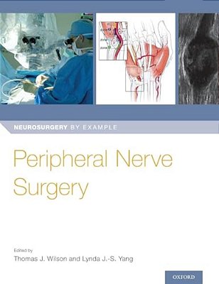 Peripheral Nerve Surgery-..