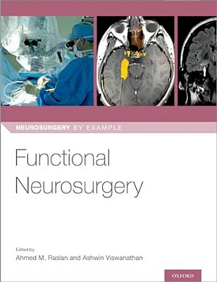 Functional Neurosurgery-..