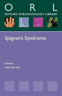 Sjogren's Syndrome-..