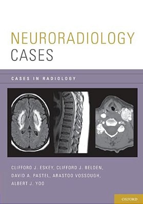 Neuroradiology Cases-..