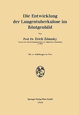 Die Entwicklung Der Lungentuberkulose Im Röntgenbild-..