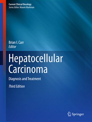 Hepatocellular Carcinoma: Diagnosis And Treatment-..