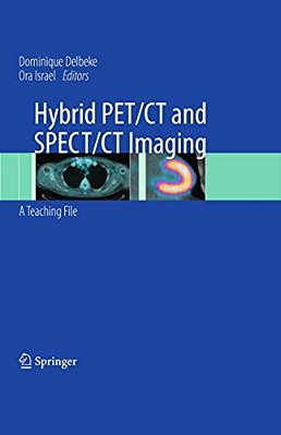 Hybrid Pet/Ct And Spect/Ct Imaging: A Teaching File [With Dvd]-..