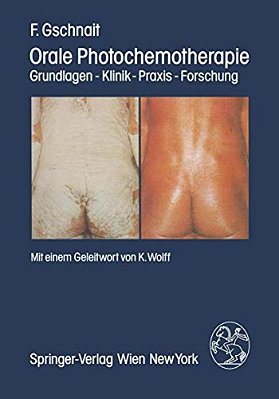 Orale Photochemotherapie: Grundlagen -- Klinik -- Praxis -- Forschung-..
