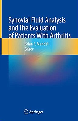 Synovial Fluid Analysis And The Evaluation Of Patients With Arthritis-..
