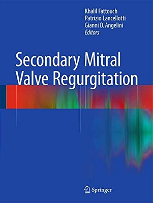 Secondary Mitral Valve Regurgitation-..