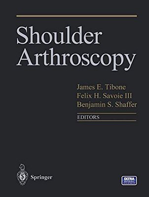 Shoulder Arthroscopy-..