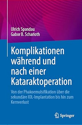 Komplikationen Während Und Nach Einer Kataraktoperation: Von Der Phakoemulsifikation Über Die Sekundäre Iol-Implantation Bis Hin Zum Kernverlust-..